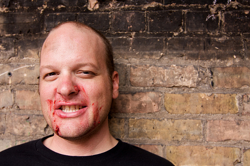 Headshot of a person with red smears around their mouth, with a brick wall background